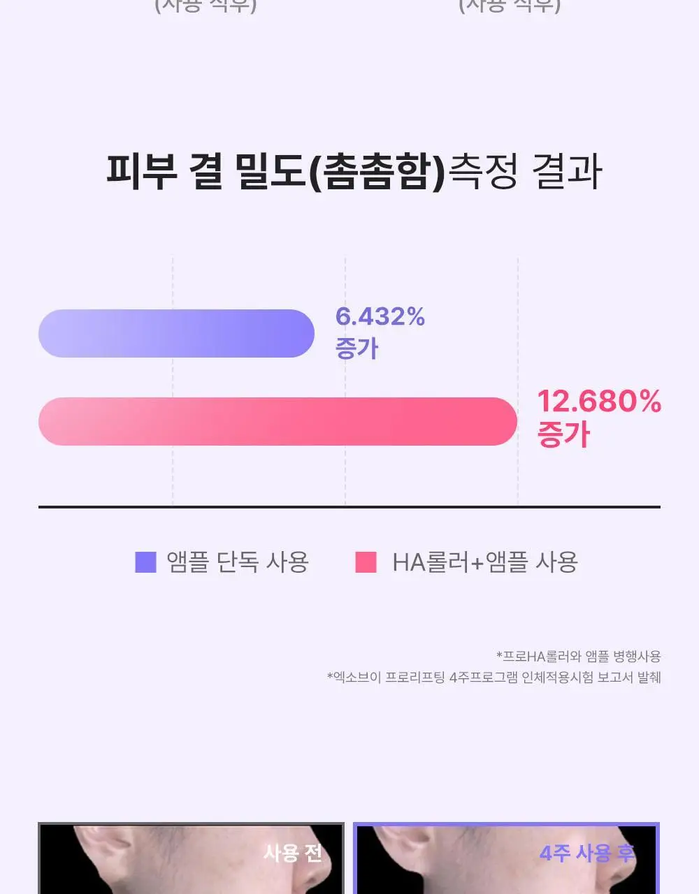 [모공교정] 아이디플라코스메틱 엑소브이 프로리프팅 세트(리프팅 앰플 5ml + MTS 롤러) 상세페이지 34